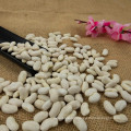 New Crop Natural Dried White Kidney Beans